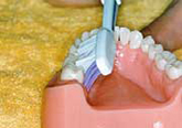 치아 안쪽의 어금니를 칫솔을 이용해 아래에서 위로 닦아냅니다.